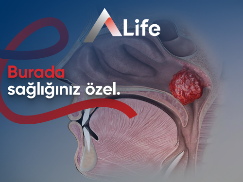 Geniz Eti Ameliyatı Ne Kadar Sürer?